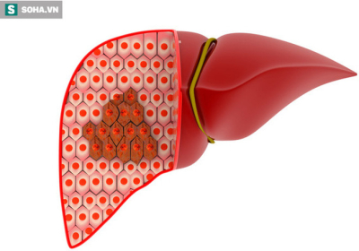4 cách để 'phong tỏa' tế bào ung thư gan, đừng để cứ hễ phát hiện là đã ở giai đoạn muộn