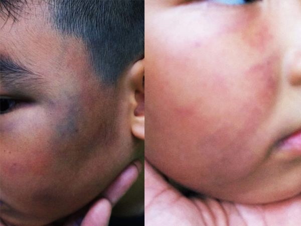 Ảnh bìa bài viết 625071