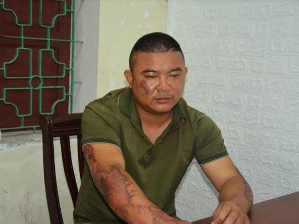 Ảnh bìa bài viết 633642