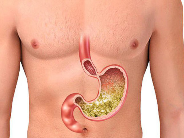 Ảnh bìa bài viết 636909