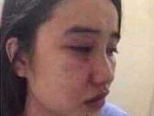 Ảnh bìa bài viết 643785