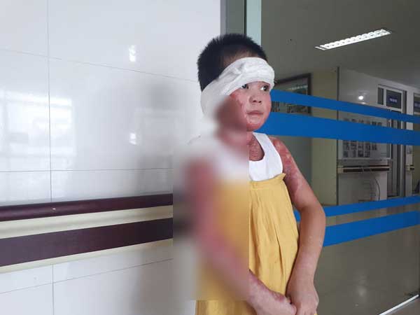 Ảnh bìa bài viết 643764