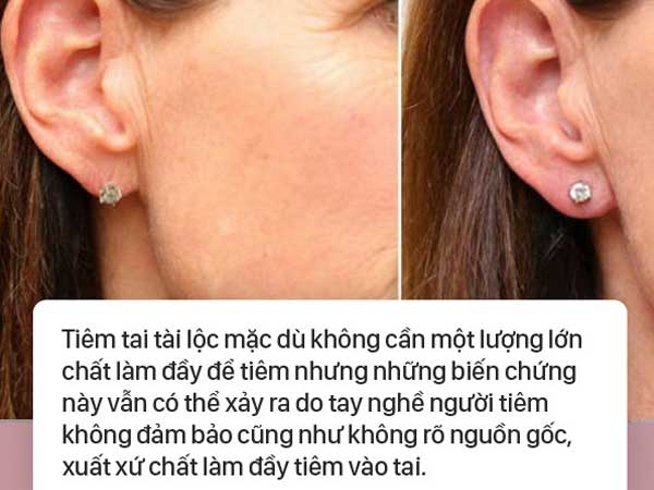Ảnh bìa bài viết 644782