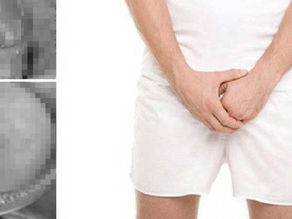Ảnh bìa bài viết 646814