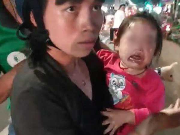 Ảnh bìa bài viết 649982