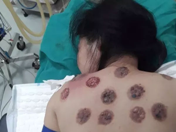 Ảnh bìa bài viết 650475