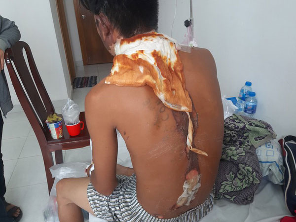 Ảnh bìa bài viết 652529