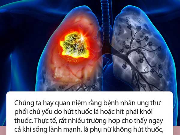 Ảnh bìa bài viết 655488