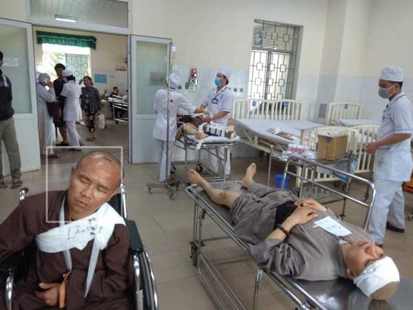 Ảnh bìa bài viết 655857
