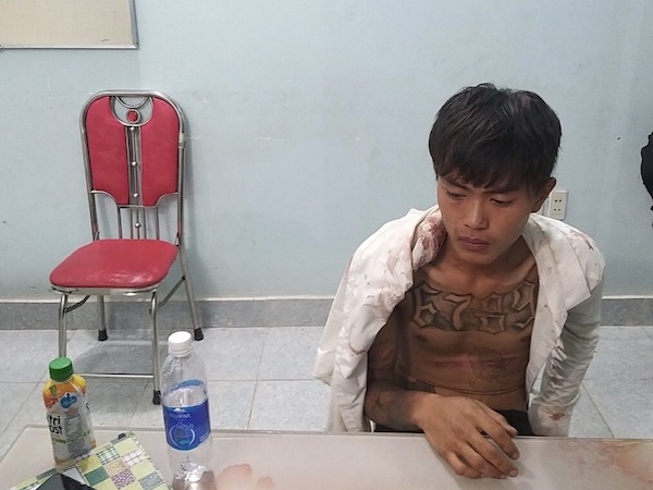 Ảnh bìa bài viết 658445