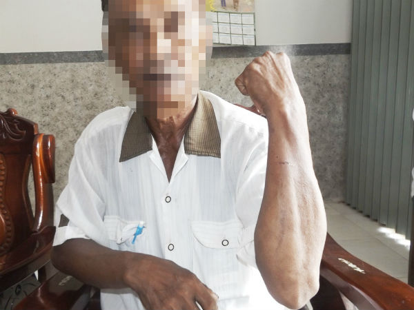 Ảnh bìa bài viết 660472