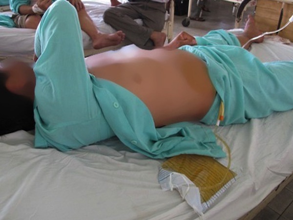 Ảnh bìa bài viết 661396