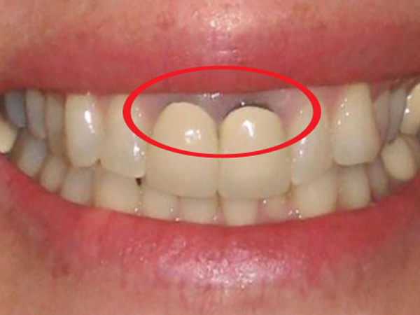 Ảnh bìa bài viết 668532