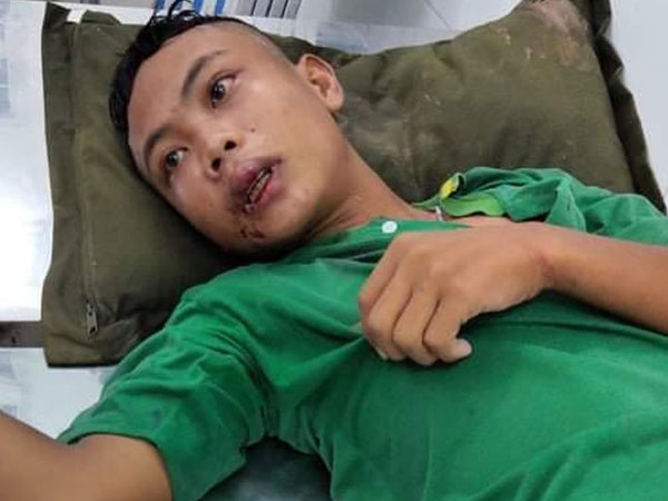 Ảnh bìa bài viết 678421