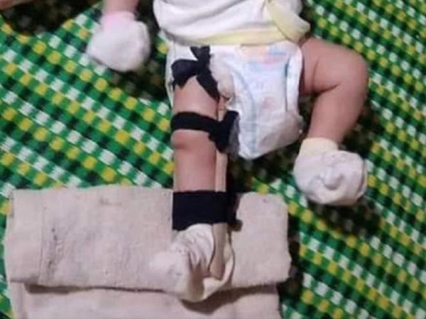 Ảnh bìa bài viết 684619