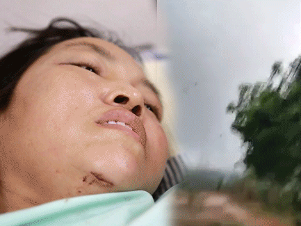 Ảnh bìa bài viết 686195