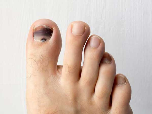 Ảnh bìa bài viết 686820