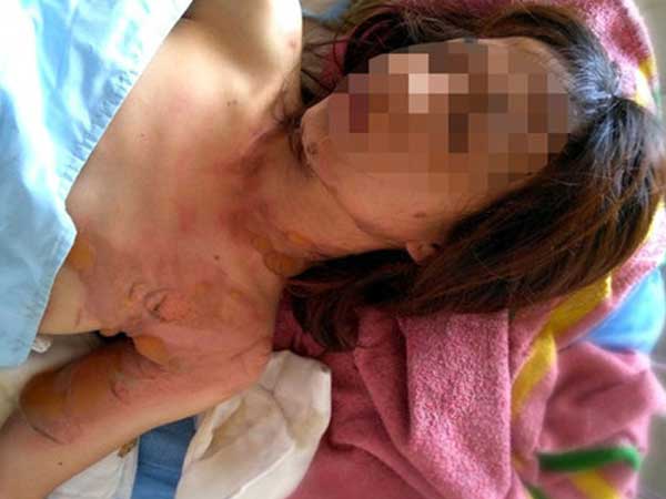 Ảnh bìa bài viết 689469