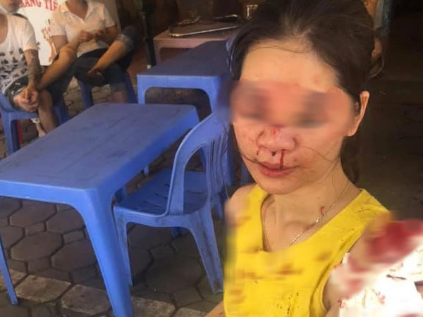 Ảnh bìa bài viết 689563