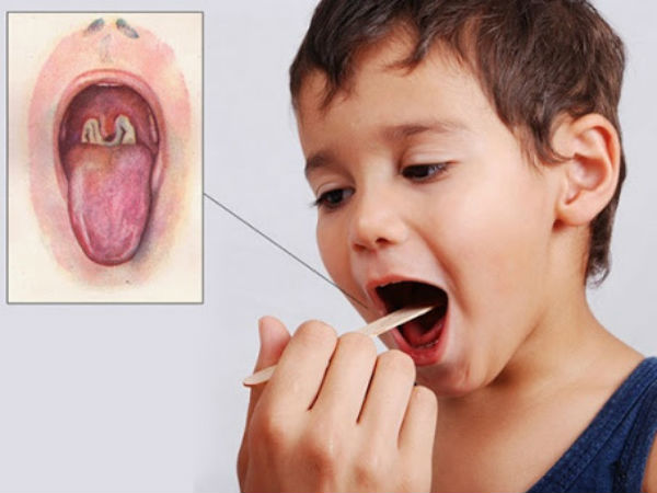 Ảnh bìa bài viết 691041