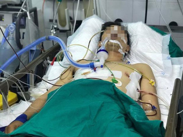 Ảnh bìa bài viết 693294