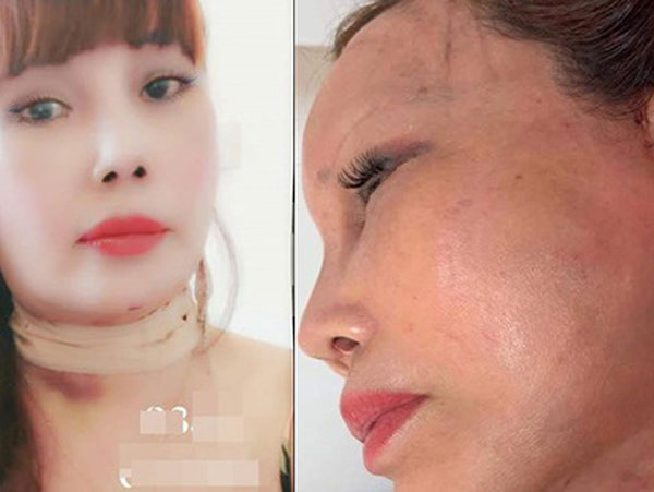 Ảnh bìa bài viết 693837