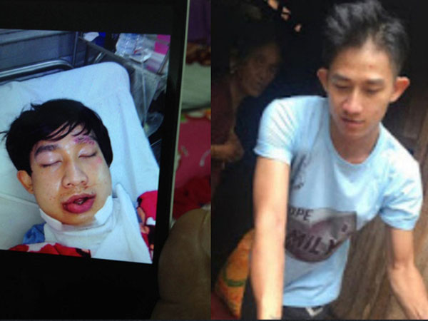 Ảnh bìa bài viết 694716
