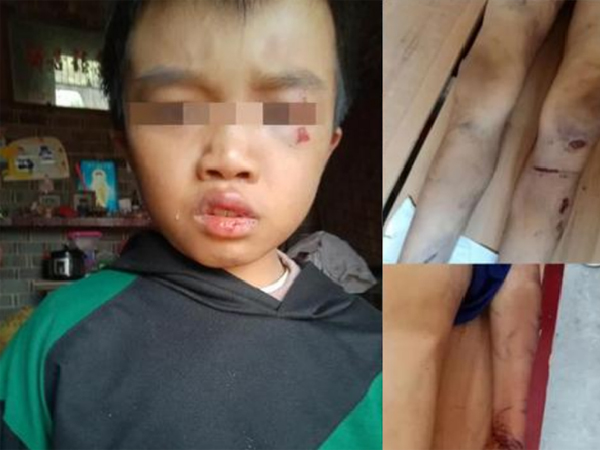 Ảnh bìa bài viết 698285