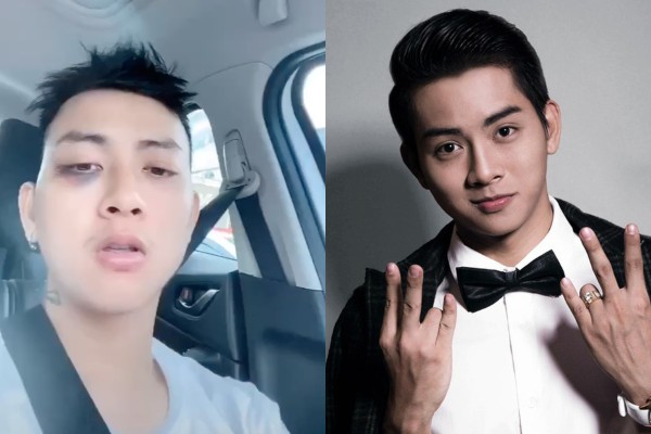 Ảnh bìa bài viết 702182