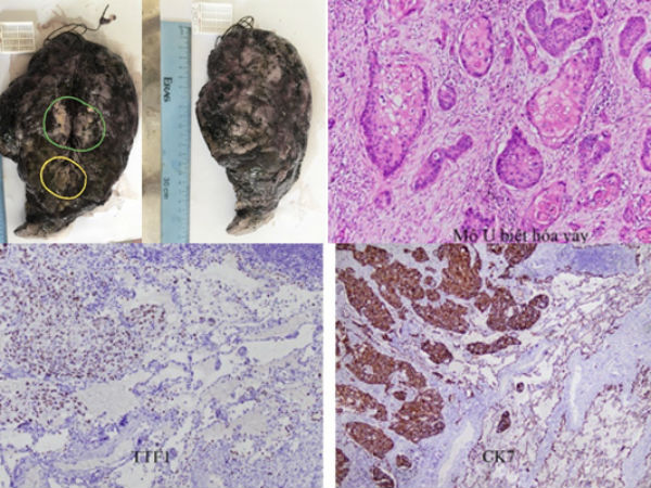 Ảnh bìa bài viết 702590