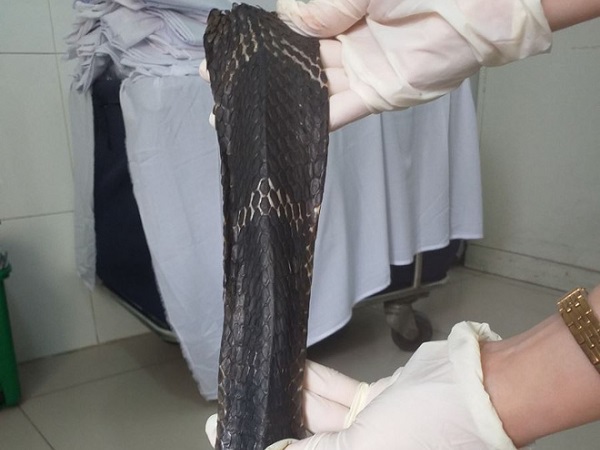 Ảnh bìa bài viết 707435