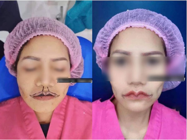 Ảnh bìa bài viết 712068