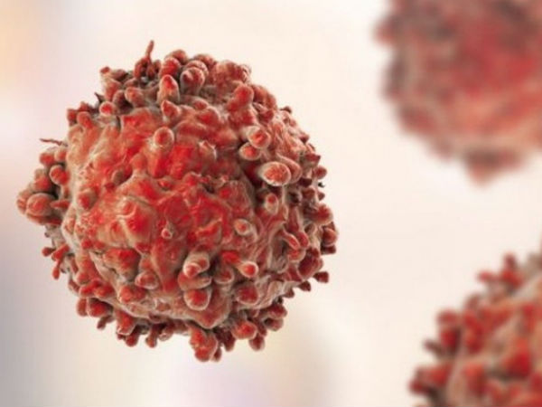 Ảnh bìa bài viết 716696