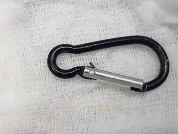 Ảnh bìa bài viết 718187