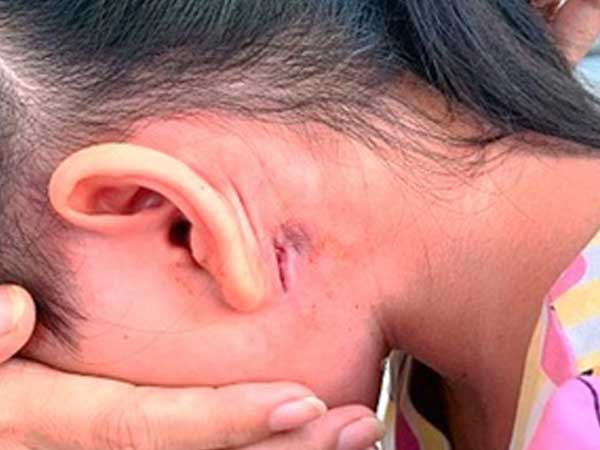 Ảnh bìa bài viết 719707