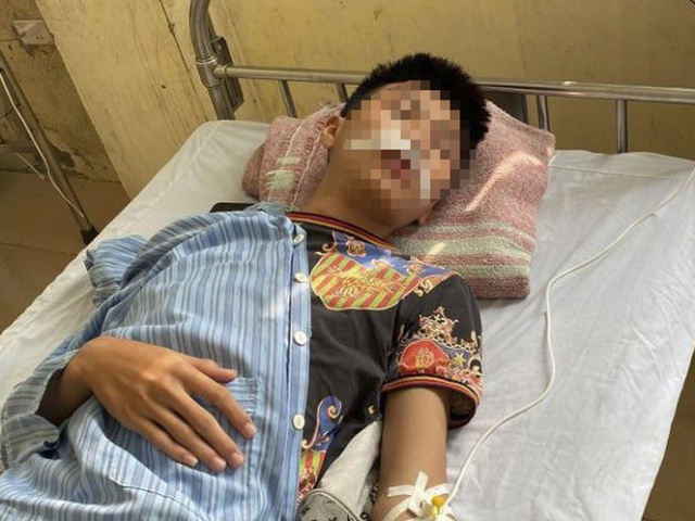 Ảnh bìa bài viết 721083