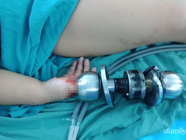 Ảnh bìa bài viết 722303