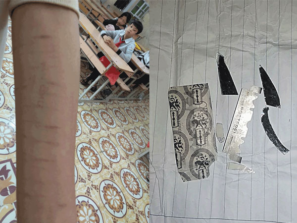 Ảnh bìa bài viết 722752