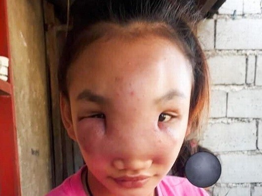 Ảnh bìa bài viết 723086