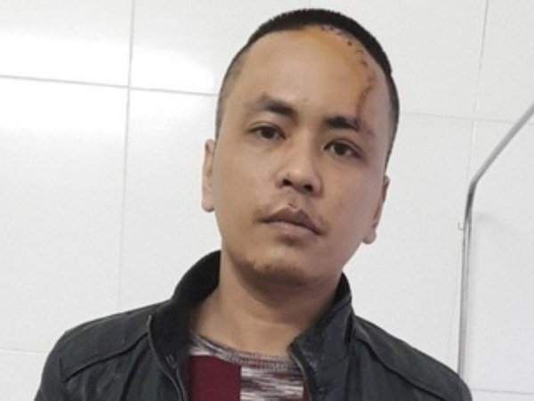 Ảnh bìa bài viết 723383