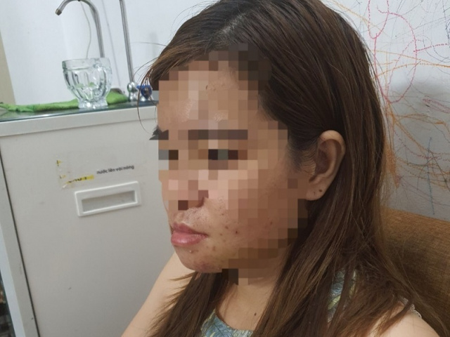 Ảnh bìa bài viết 724139
