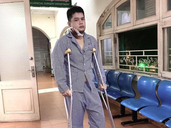 Ảnh bìa bài viết 724545