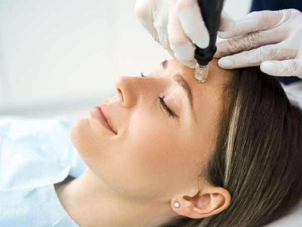 Ảnh bìa bài viết 727186