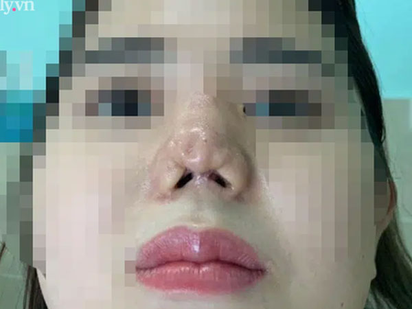 Ảnh bìa bài viết 730060