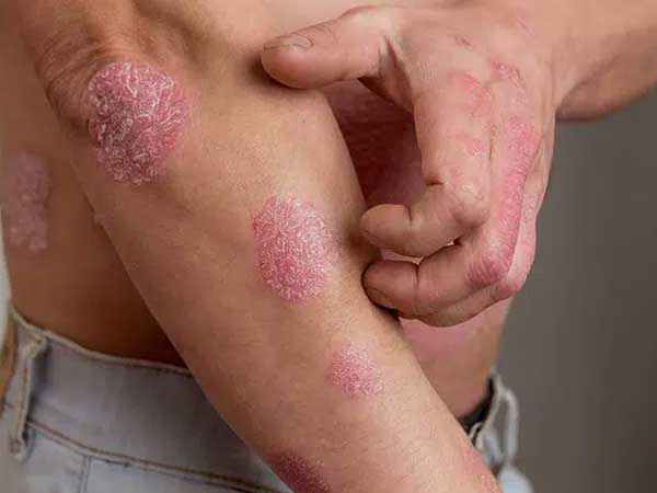 Ảnh bìa bài viết 730721