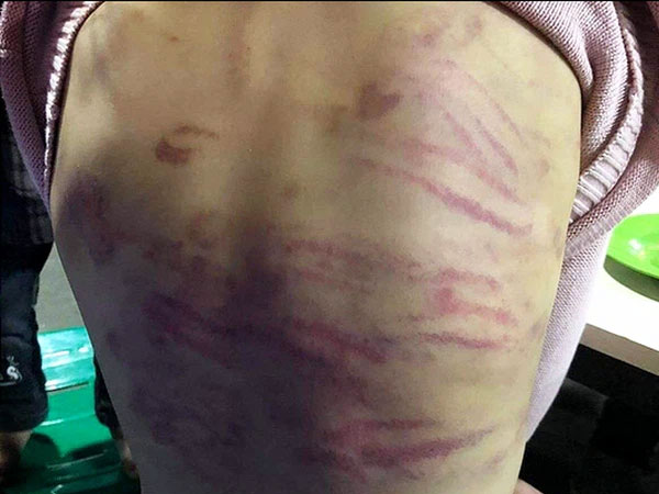 Ảnh bìa bài viết 738747