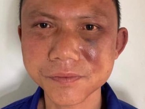 Ảnh bìa bài viết 739677