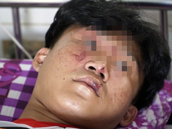 Ảnh bìa bài viết 739850