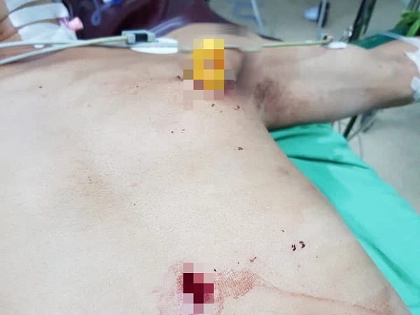 Ảnh bìa bài viết 740522
