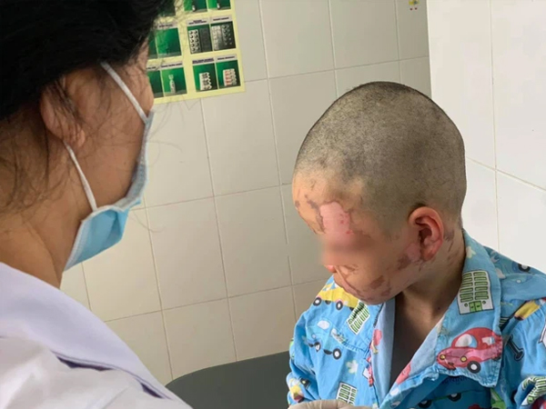 Ảnh bìa bài viết 746104